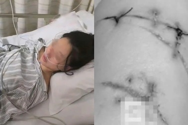 Cô gái xinh đẹp bị đâm 22 nhát dao, thoát chết nhờ nâng ngực