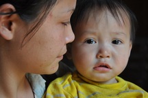 Đáng thương bé 1 tuổi ăn cháo loãng cầm hơi, mong chờ ngày được phẫu thuật