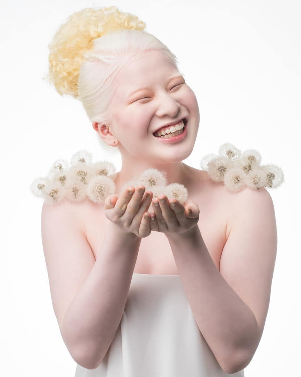 Cô gái bạch tạng từng bị cha mẹ bỏ rơi, trở thành người mẫu tạp chí Vogue - 5