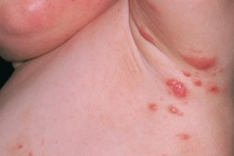 5 cách bảo vệ da cho trẻ dịp Tết phụ huynh cần biết