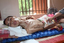 Rơi từ tầng 3 nam thanh niên đếm sự sống từng ngày