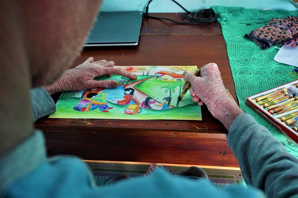 Cuộc sống của cậu bé người rắn từng bị xa lánh bây giờ ra sao? - 6 Cuộc sống của cậu bé người rắn từng bị xa lánh bây giờ ra sao? - 6