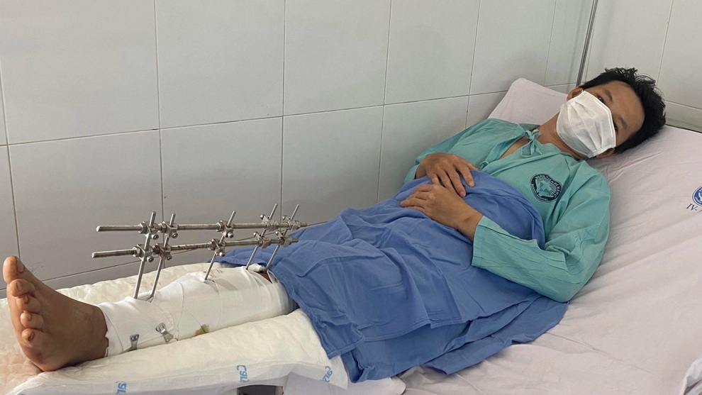 Thương 2 cha con gặp tai nạn gãy đùi trên đường về quê tránh dịch - 2 Thương 2 cha con gặp tai nạn gãy đùi trên đường về quê tránh dịch - 2