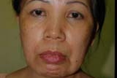 Bán ma tuý “đội lốt” hiệu thuốc tư nhân