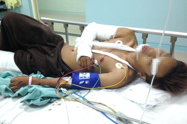 Côn đồ chém gục một thanh niên ngay trên đường