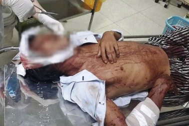 Con rể chém cha và anh vợ trọng thương sau khi đi ăn giỗ về