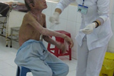 Buồn vui nghề điều dưỡng bệnh da liễu