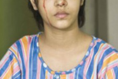 Bé gái Ấn Độ mắc căn bệnh cực lạ: Tự chảy máu