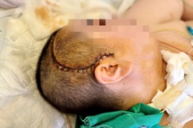 Hà Nội: Sau chầu nhậu, người phụ nữ 100kg bị tụt kẹt não nguy kịch