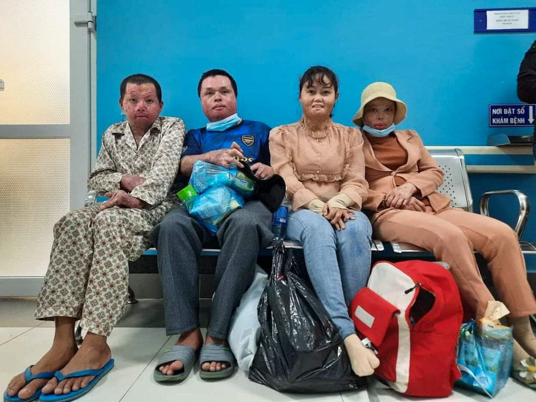 Tình yêu hồi sinh bà mẹ hai con từng bị chồng cũ thiêu sống - 2 Tình yêu hồi sinh bà mẹ hai con từng bị chồng cũ thiêu sống - 2