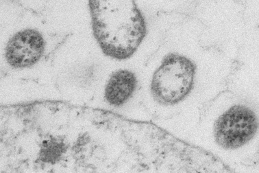 Chế tạo vi-rút “thiết kế” để tiêu diệt ung thư