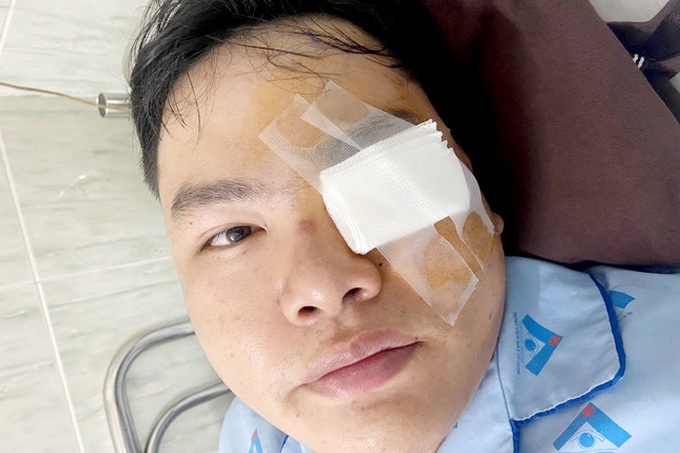 Xác minh vụ thanh niên bị gậy CSGT va vào mắt bị thương ở TPHCM - 1