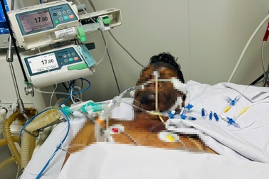 Đang khỏe mạnh bỗng hôn mê, ôm nợ trăm triệu đồng vì mắc thủy đậu