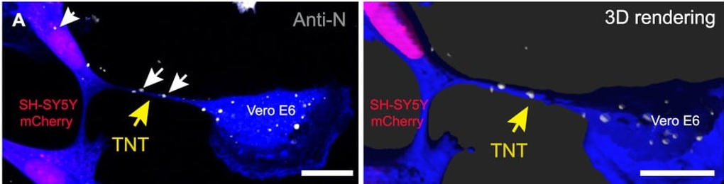 Hé lộ con đường virus SARS-CoV-2 xâm nhập vào các tế bào thần kinh - 2 Hé lộ con đường virus SARS-CoV-2 xâm nhập vào các tế bào thần kinh - 2