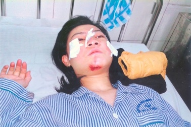 Bị tai nạn thảm khốc, 4 người trong gia đình lâm vào tình cảnh nguy kịch