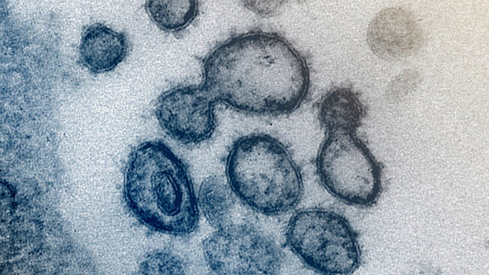 Thuốc điều trị HIV không hiệu quả với COVID-19? - 1 Thuốc điều trị HIV không hiệu quả với COVID-19? - 1