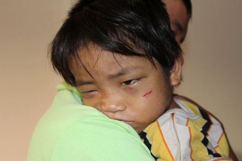 “Địa ngục trần gian” của cậu bé 3 tuổi bị bắt đi ăn xin