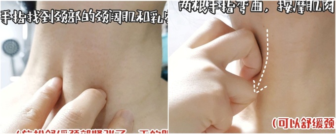 Vùng da cổ nhăn nheo của cô nàng này đã thay đổi hoàn toàn chỉ nhờ cách làm đơn giản vô cùng - Ảnh 4. Vùng da cổ nhăn nheo của cô nàng này đã thay đổi hoàn toàn chỉ nhờ cách làm đơn giản vô cùng - Ảnh 4.
