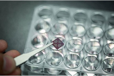 Nghiên cứu mới sử dụng huyết thanh người để phát hiện các cơn đau tim