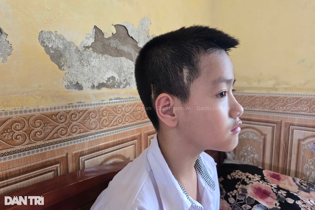 Người mẹ góa 3 lần mổ ung thư, khẩn cầu được sống để nuôi 2 con nhỏ - 3 Người mẹ góa 3 lần mổ ung thư, khẩn cầu được sống để nuôi 2 con nhỏ - 3