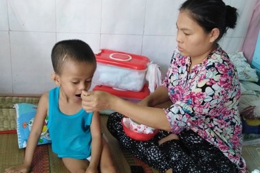 Thương cháu bé sinh ra đã không có hậu môn còn bị não úng thủy