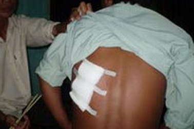 Hai bảo vệ bị côn đồ đánh trọng thương