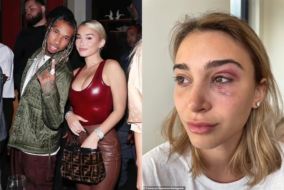 Rapper Tyga bị bắt vì bạo hành bạn gái mới - 1 Rapper Tyga bị bắt vì bạo hành bạn gái mới - 1