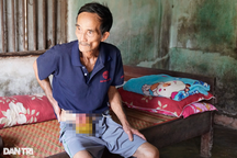 Người đàn ông 20 năm "ruột để ngoài da", sống trong căn nhà chờ sập