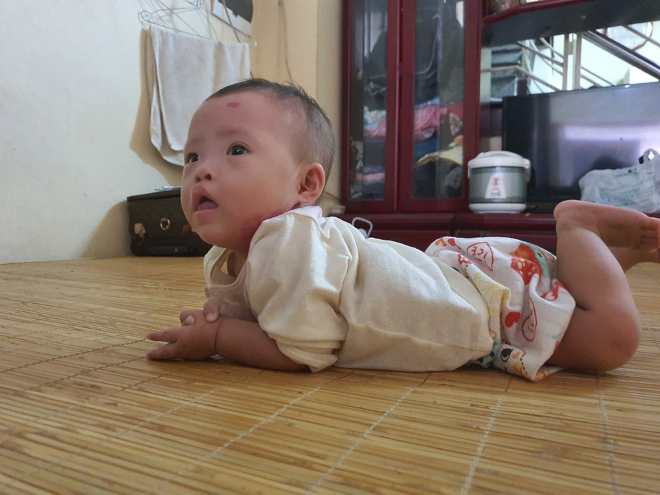 Bạn đọc Dân trí tiếp tục giúp đỡ bé gái mắc đa dị tật hơn 66 triệu đồng - 3 Bạn đọc Dân trí tiếp tục giúp đỡ bé gái mắc đa dị tật hơn 66 triệu đồng - 3