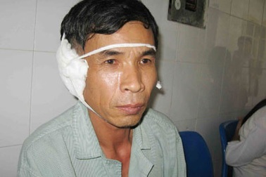 Bệnh ở tai: Nặng vì chủ quan