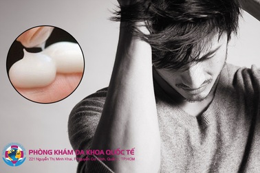 Những ảnh hưởng khôn lường đến sức khỏe sinh sản nam giới