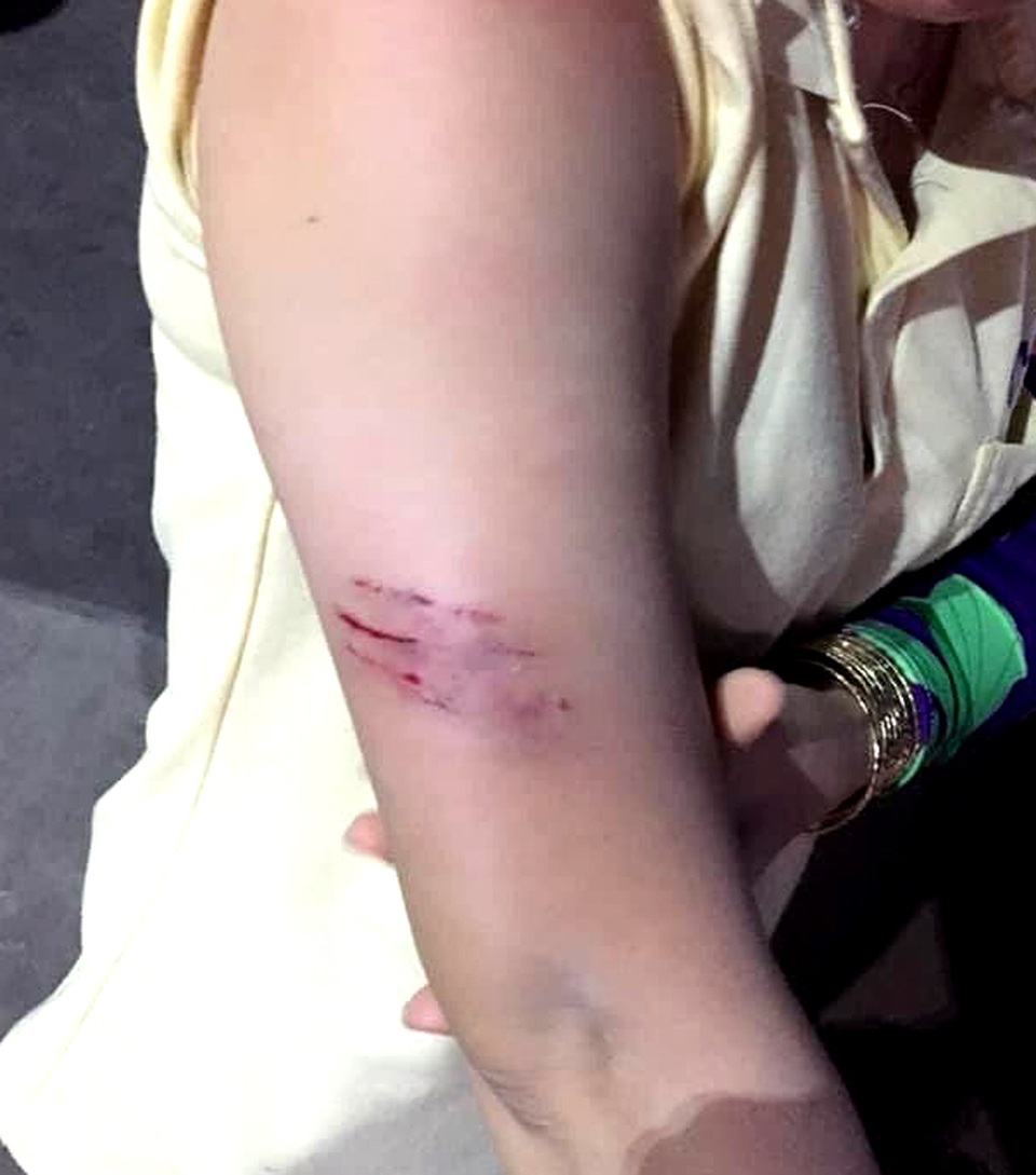 Vì sao đàn khỉ liên tục hung hãn tấn công người? - 1 Vì sao đàn khỉ liên tục hung hãn tấn công người? - 1