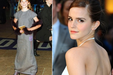 Emma Watson: Từ "cô phù thủy nhỏ" tới người đẹp gợi tình (phần 1)
