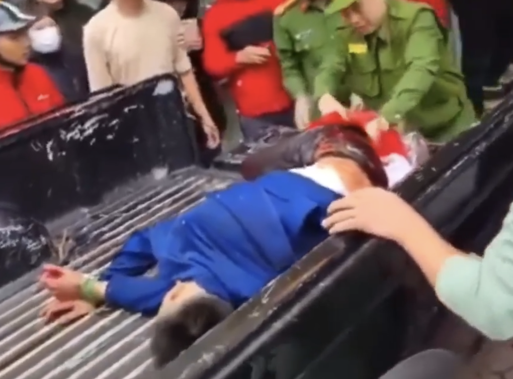 Kẻ cướp tiệm vàng bị bắt trong tình trạng be bét máu - 2 Kẻ cướp tiệm vàng bị bắt trong tình trạng be bét máu - 2