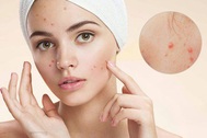 Xuất hiện 4 dấu hiệu trên mặt có thể gan đã bị bệnh