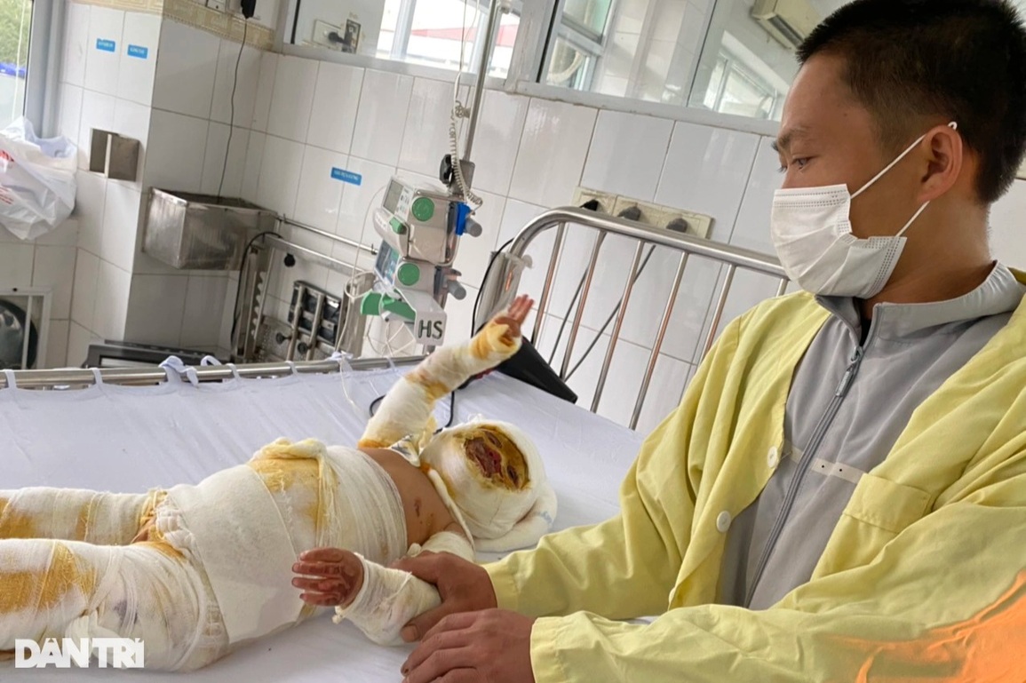 Bé 3 tuổi bị nhấn chìm trong ngọn lửa hung dữ cầu xin được cứu sống - 5 Bé 3 tuổi bị nhấn chìm trong ngọn lửa hung dữ cầu xin được cứu sống - 5