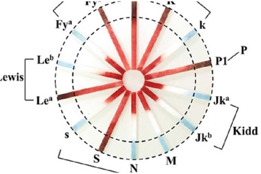 Que thử xác định nhóm máu chưa mất đến một phút