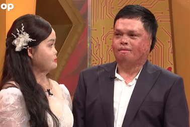 Chàng trai bị cha từ mặt vì cưới mẹ đơn thân cùng cảnh ngộ bị bỏng