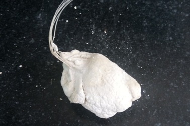 Hy hữu một thiếu niên đưa cước câu cá vào niệu đạo