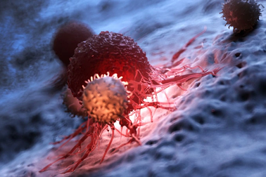 5 thách thức lớn khiến con người vẫn chưa thể xóa sổ được ung thư