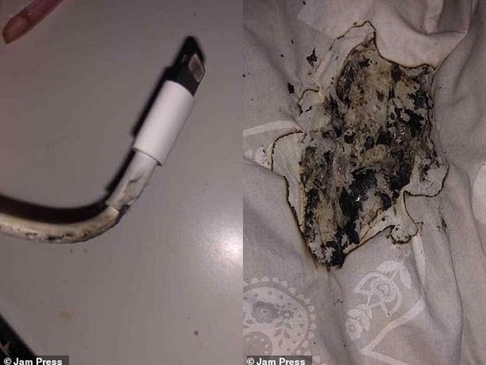Thiếu nữ bị bỏng mặt vì iPhone bất ngờ phát nổ khi cắm sạc qua đêm - 1 Thiếu nữ bị bỏng mặt vì iPhone bất ngờ phát nổ khi cắm sạc qua đêm - 1