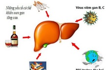 Men gan cao và cách giảm không cần thuốc