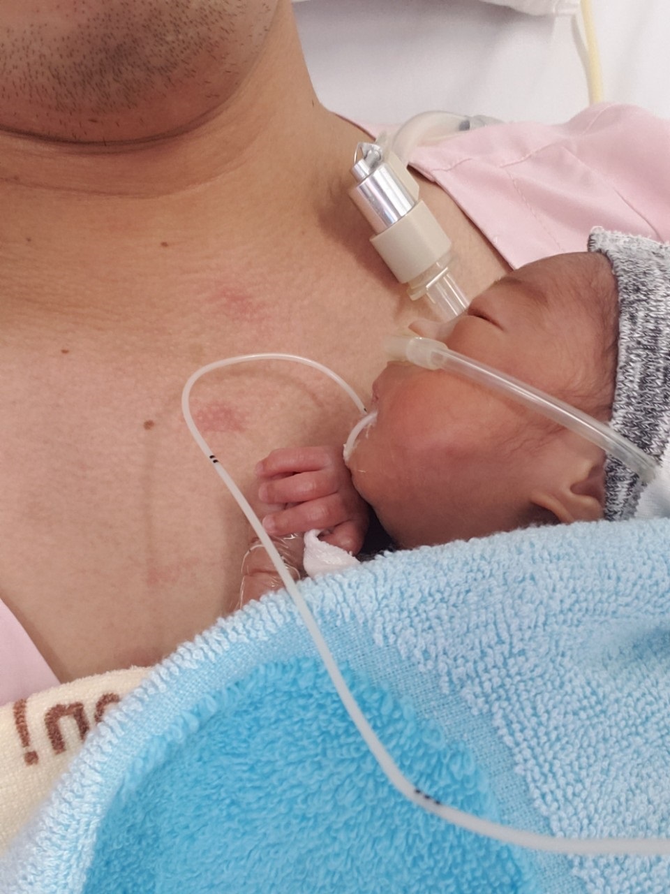 Câu chuyện bất ngờ phía sau sự hồi sinh kỳ diệu của một cháu bé - 2 Câu chuyện bất ngờ phía sau sự hồi sinh kỳ diệu của một cháu bé - 2