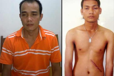 Phá đường dây bán thận quy mô lớn sang Trung Quốc 