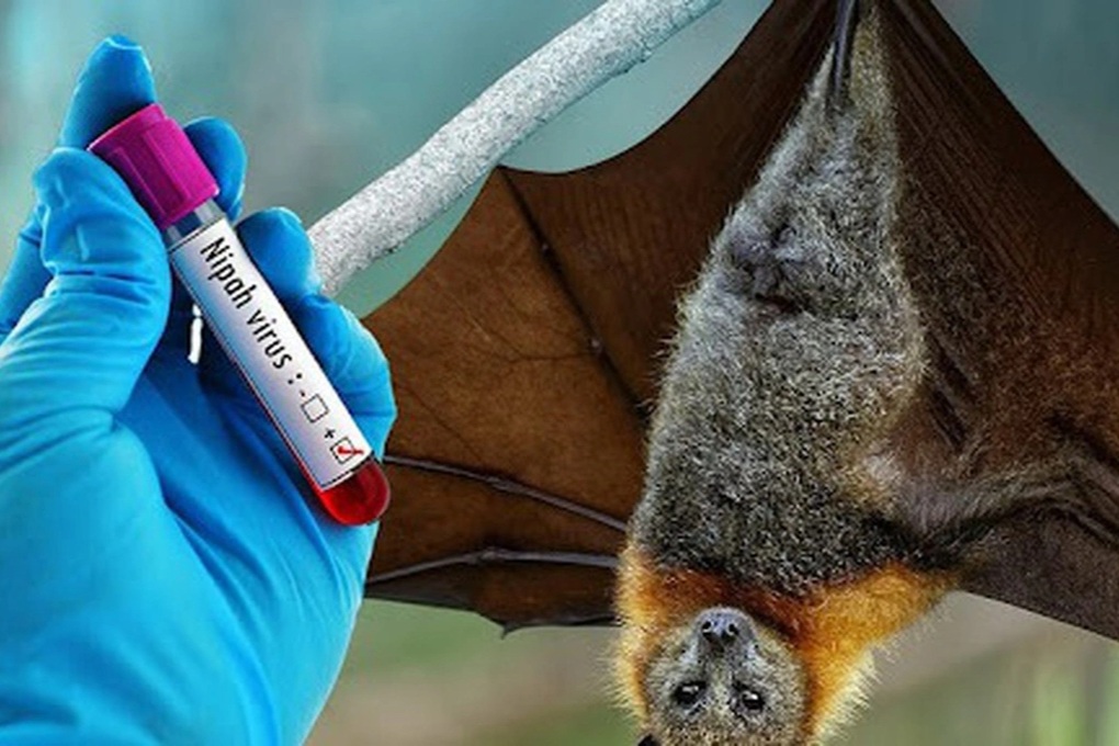 Bộ Y tế hỏa tốc yêu cầu siết chặt phòng dịch do virus Nipah - 1
