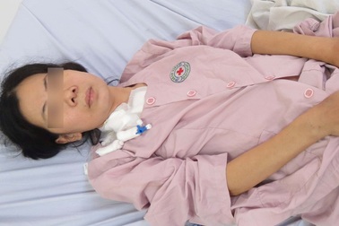 Cưa xương ức, cứu bệnh nhân bị viêm màng ngoài tim phức tạp