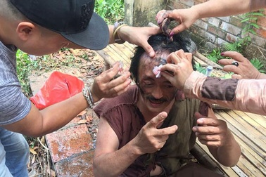 Thực hư chuyện diễn viên Giang còi bị bạn diễn đánh chảy máu mặt