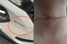 Hà Nội: Dây diều "sắc như dao" cứa ngang cổ người, chém đứt đầu xe ô tô