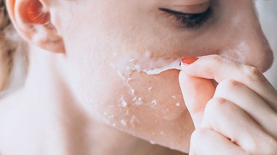 Đã có giải pháp sạch mụn, căng bóng đến từ Hoa Kỳ - 1 Đã có giải pháp sạch mụn, căng bóng đến từ Hoa Kỳ - 1