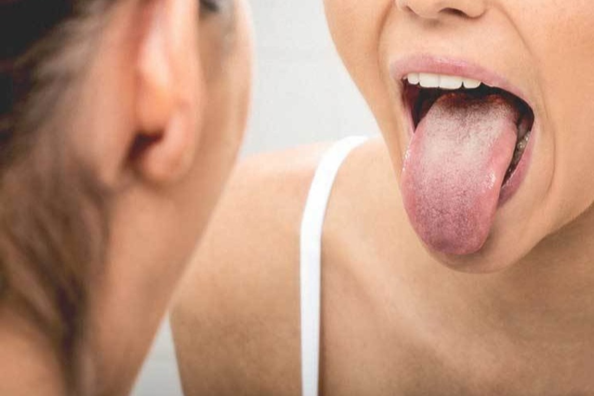 6 nguyên nhân gây ung thư lưỡi bạn dễ dàng bỏ qua - 1 6 nguyên nhân gây ung thư lưỡi bạn dễ dàng bỏ qua - 1